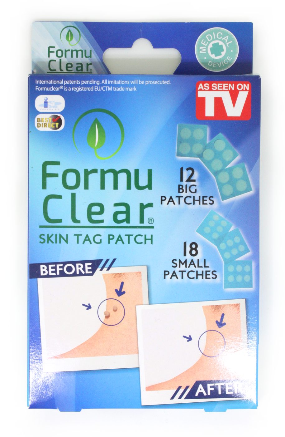 Balenie náplastí FormuClear na kožné výrastky vedľa cenovky